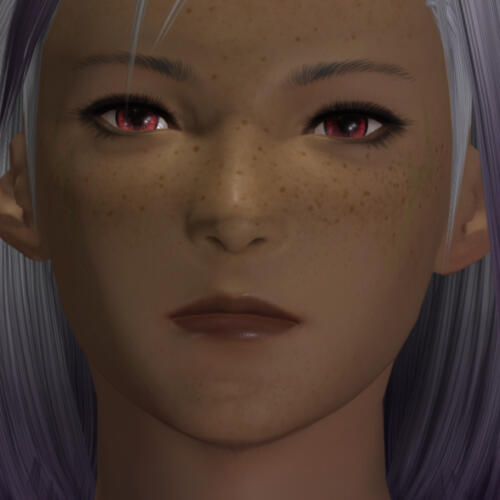 Face; Note Misshapen Pupils